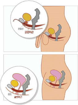 알파메딕